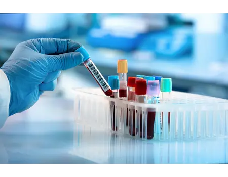 Treatment Image 1 V2